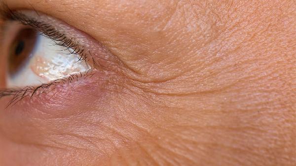 脸部松弛、有皱纹要如何解决