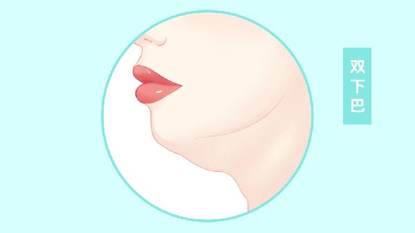 怎么去掉双下巴的妙招