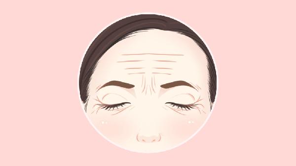 抬头纹可以去掉吗