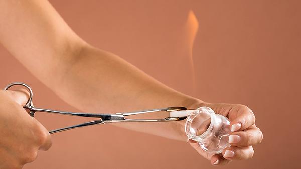 拔罐减肥好不好