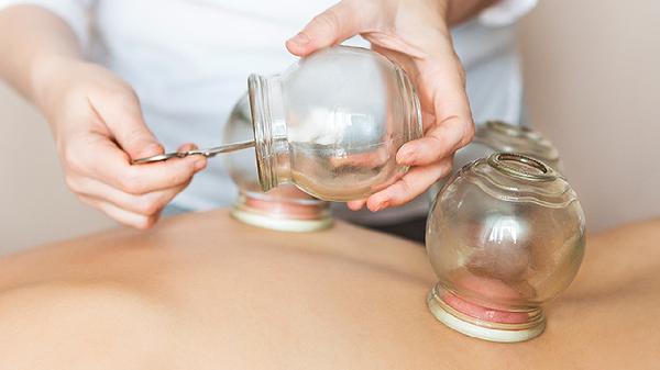 拔罐减肥有效吗