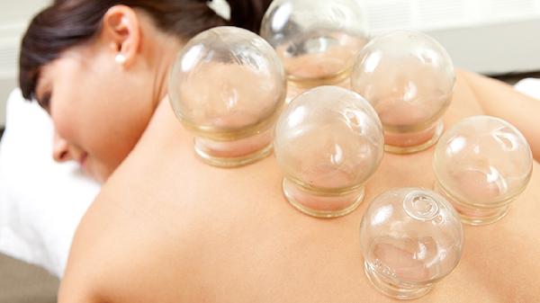 拔罐减肥有用吗
