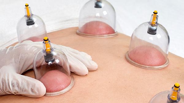 拔罐减肥食谱是什么