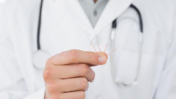 针灸可以减肥吗