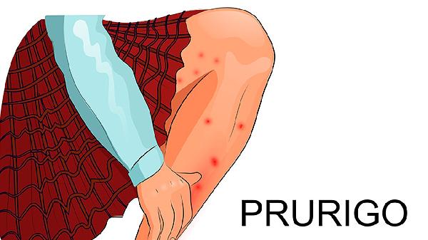 双腿无力是什么病兆