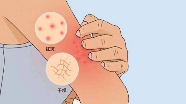 皮肤病_皮肤病症状表现