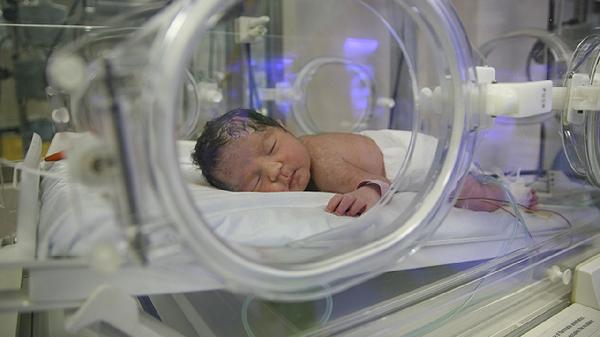 双氯芬酸钠气雾剂作用有哪些