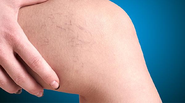 祖师麻关节止痛膏治疗什么病