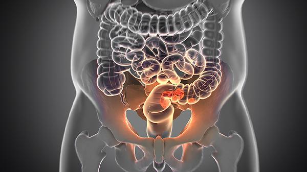 复方阿嗪米特肠溶片注意事项有哪些
