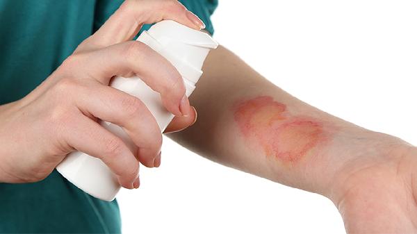 烧伤肤康液的功效有哪些