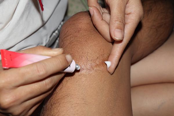 复方木芙蓉涂鼻软膏主要治什么病