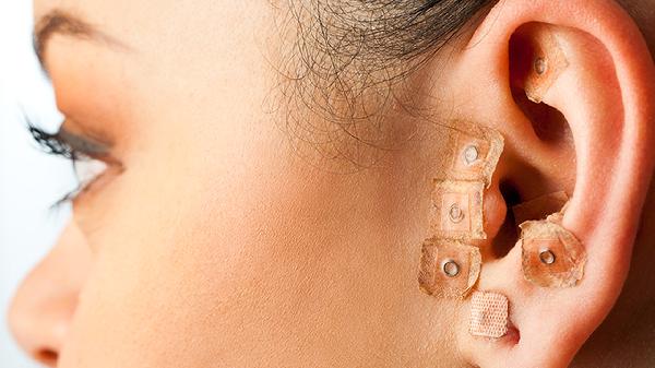 猴耳环消炎片适用人群有哪些