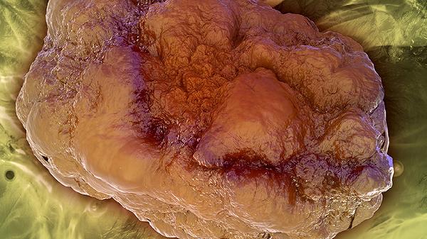 抗癌平丸可以治疗什么疾病