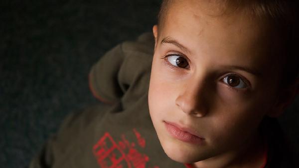 孩子脸上有湿疹怎么办