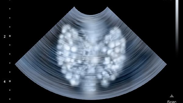 B超一般检查些什么