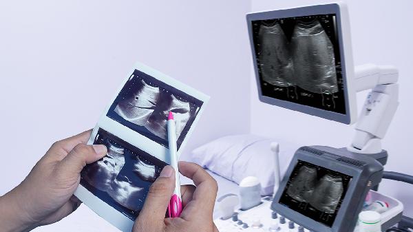 B超常规检查是检查什么