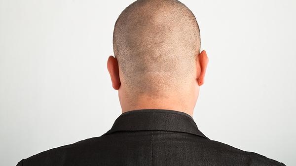 头发越掉越少?营养师私藏的黄金搭配,每天一勺就行