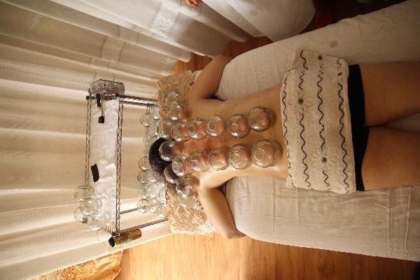肚子拔罐能减肥吗