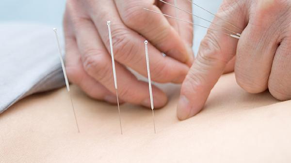 埋线减肥效果好不好呀