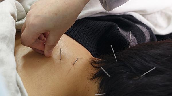 埋线减肥法的两大禁忌是什么