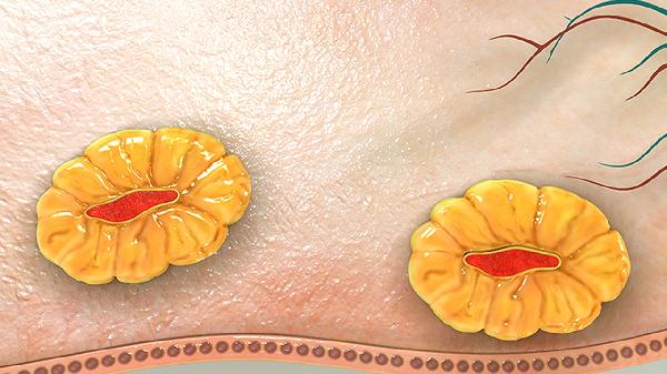 60老年人切除卵巢有什么后果