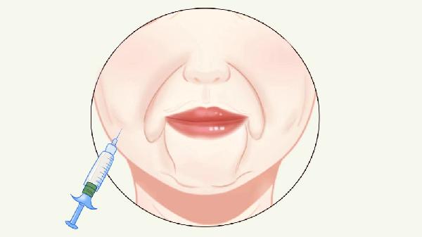 非手术面部除皱的方法是什么