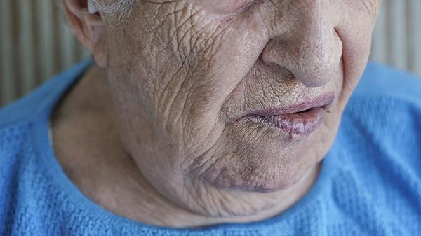 脸部凹陷脸歪的原因是什么