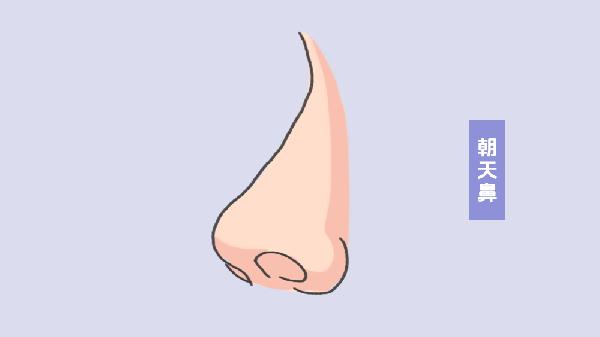 朝天鼻子整形方法