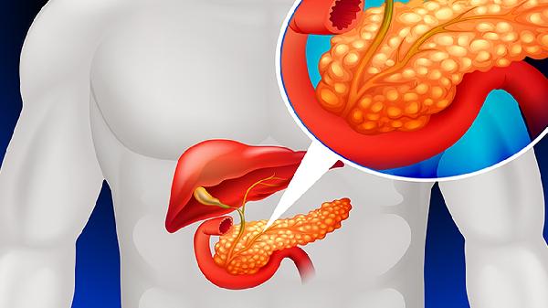 胰胆炎合剂可以治疗什么病