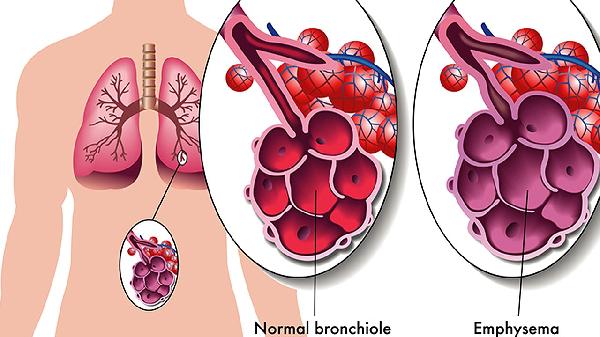 清肺止咳丸主治什么疾病