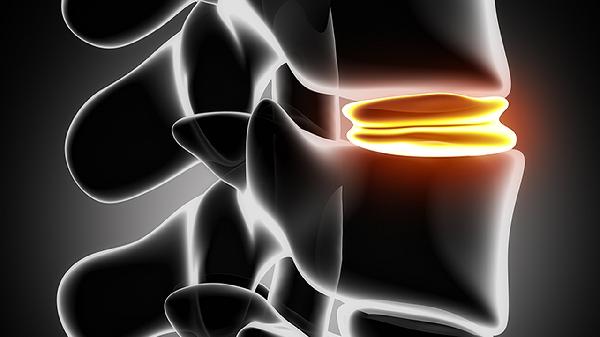 骨增生镇痛膏可以治疗什么疾病