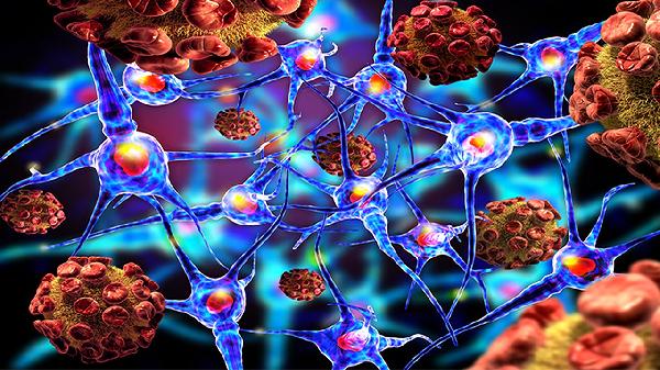 神经官能症需要做什么检查