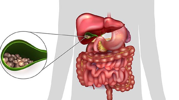 胰酶肠溶片的功效有哪些