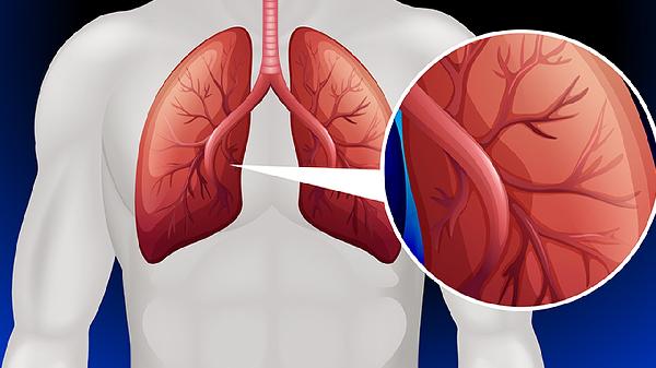 通宣理肺片使用时需要注意什么