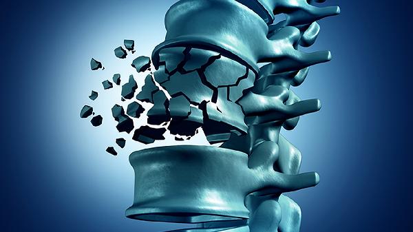 骨骼风痛片的作用是什么