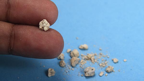 结石通胶囊的作用都有哪些