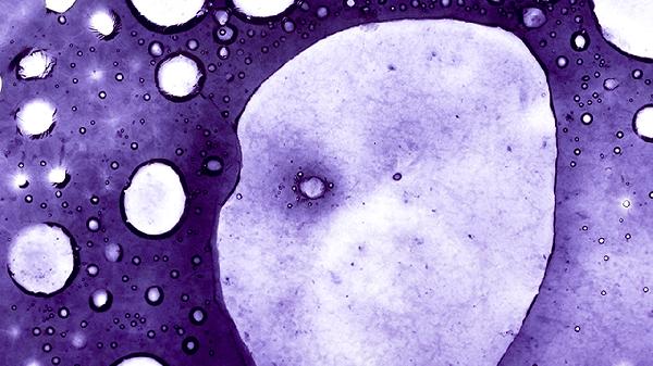 tct检查细胞量小于40正常吗