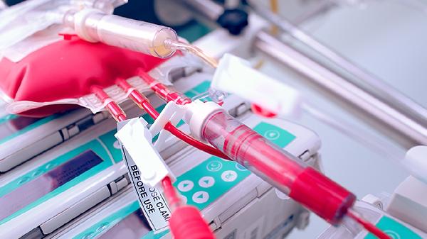 脐血流是什么仪器检查