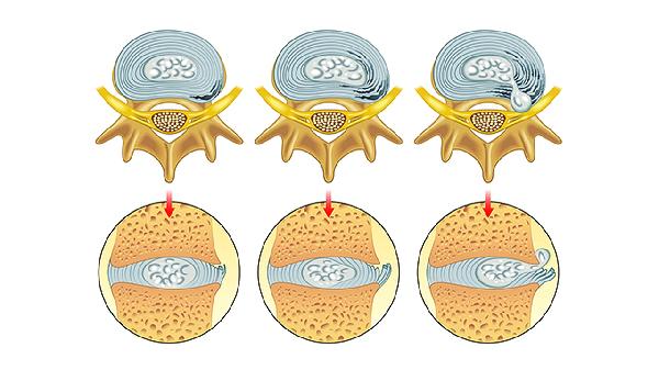 7个不起眼的小习惯正在喂养癌细胞！最后一个几乎人人中招