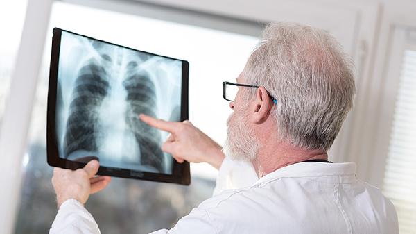 医生不说但你该知：4种病怕板栗，早吃早受益！