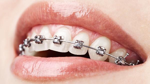 天天饭后漱口的人注意！牙齿正在偷偷变差