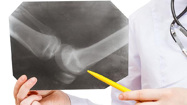 每天吃这个，血糖居然越来越稳！医生都惊讶了