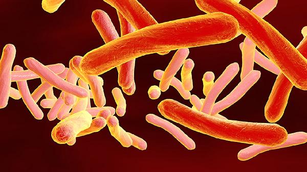 怎么检查尖锐湿疣病毒啊