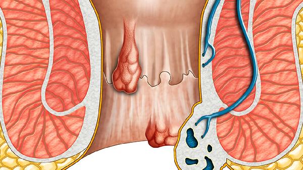 脑血管疾病需要做什么检查