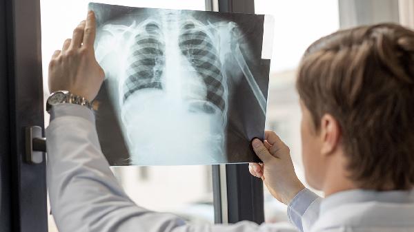 冠脉CT检查后多久出结果