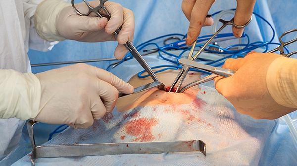 医生不会告诉你：饭后吃水果也有禁忌清单