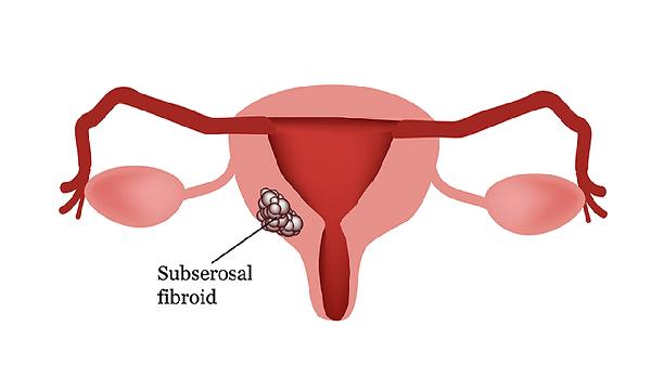 宫颈癌筛查有5项阳性是怎么回事