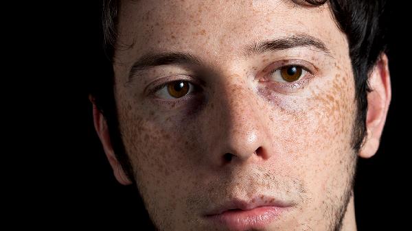 龟头上出现红斑怎么办