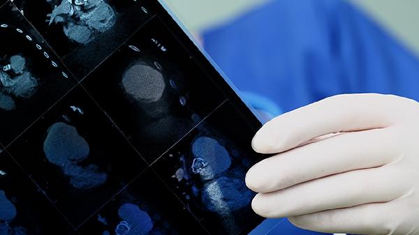 医生不会告诉你的喝水减肥秘诀，试过都瘦了