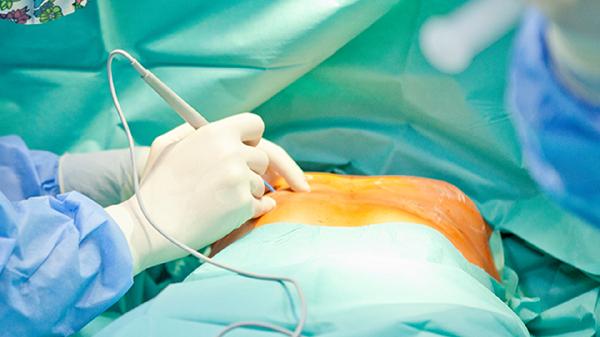 医生没告诉你的秘密：减肥快的都做对了这1点